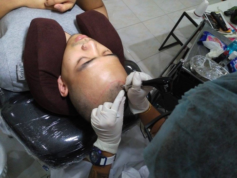 Slider image (2) Phuket Hair Clinic